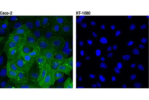  Image 28: Coronavirus Host Cell Attachment and Entry Antibody Sampler Kit