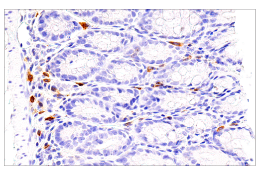 Immunohistochemistry Image 1: ICOS (E5F7E) Rabbit mAb (BSA and Azide Free)
