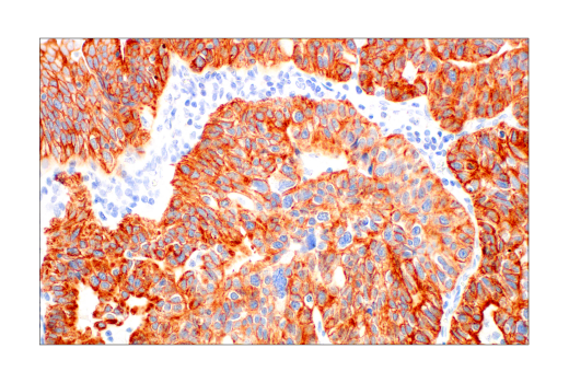 Immunohistochemistry Image 1: Pan-Keratin (AE1/AE3) Mouse mAb