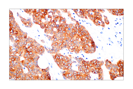 Immunohistochemistry Image 5: Pan-Keratin (AE1/AE3) Mouse mAb