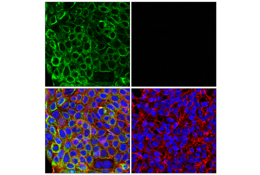 Immunofluorescence Image 1: Pan-Keratin (AE1/AE3) Mouse mAb