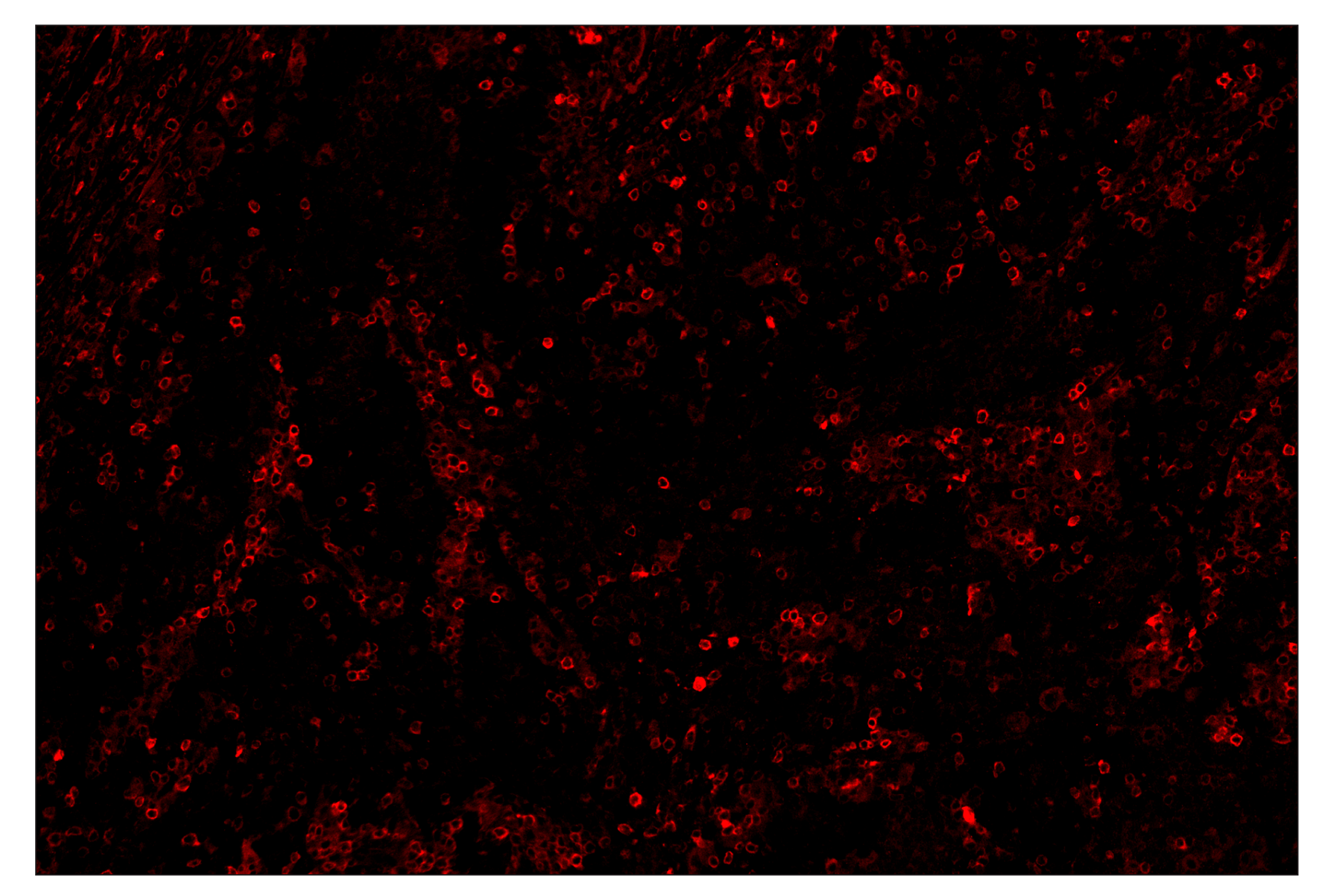 Immunohistochemistry Image 4: Phospho-SLP-76 (Ser376) (E3G9U) & CO-0018-594 SignalStar™ Oligo-Antibody Pair