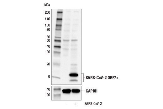 Western Blotting Image 1: SARS-CoV-2 ORF7a Antibody
