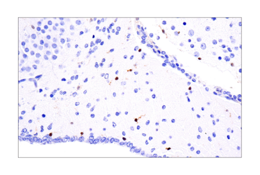  Image 35: Mouse Microglia Marker IF Antibody Sampler Kit