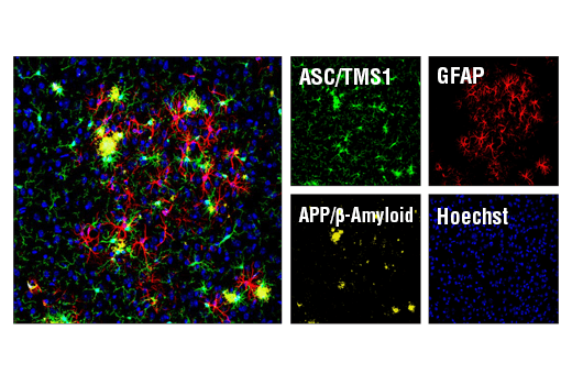  Image 65: Microglia Neurodegeneration Module Antibody Sampler Kit