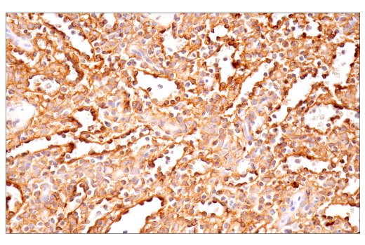 Immunohistochemistry Image 9: CD54/ICAM-1 (E3Q9N) XP® Rabbit mAb
