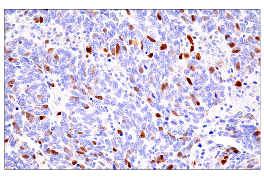 Immunohistochemistry Image 9: Cyclin A2 (E6D1J) XP® Rabbit mAb (BSA and Azide Free)