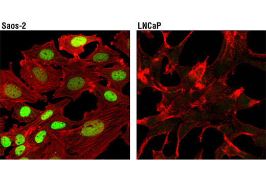 Immunofluorescence Image 1: RUNX2 (D1L7F) Rabbit mAb (BSA and Azide Free)