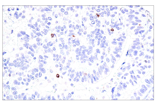 Immunohistochemistry Image 3: GNLY (E2T3D) Rabbit mAb