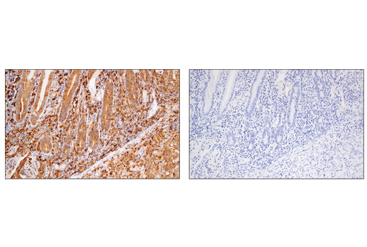  Image 48: Suppressive Myeloid Cell Phenotyping IHC Antibody Sampler Kit