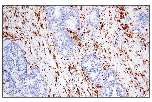  Image 56: Suppressive Myeloid Cell Phenotyping IHC Antibody Sampler Kit