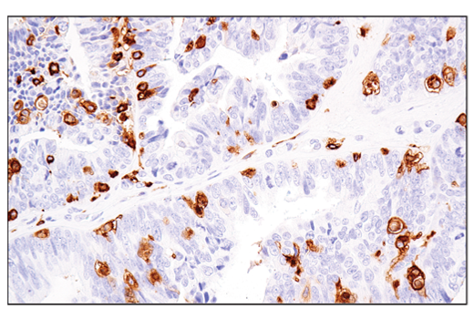  Image 63: Suppressive Myeloid Cell Phenotyping IHC Antibody Sampler Kit