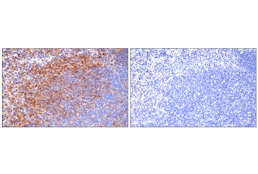 Immunohistochemistry Image 15: CD38 (E9F5A) XP® Rabbit mAb