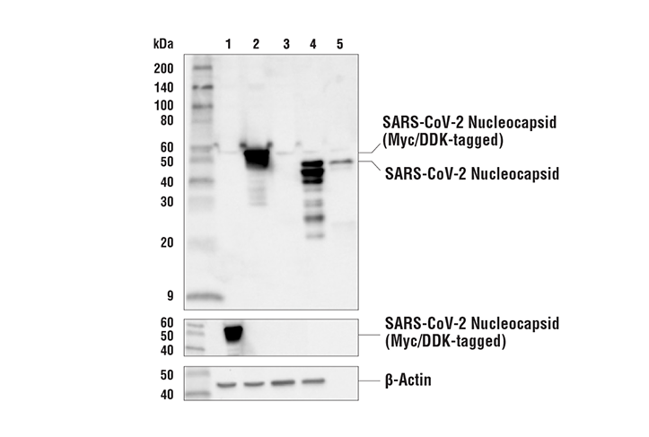 Western Blotting Image 1: SARS-CoV-1/2 Nucleocapsid Protein (1C7C7) Mouse mAb