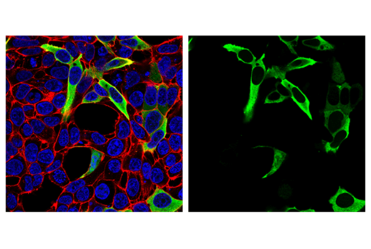 Immunofluorescence Image 2: SARS-CoV-1/2 Nucleocapsid Protein (1C7C7) Mouse mAb