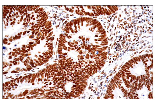 Immunohistochemistry Image 2: PBRM1/BAF180 (D4L9X) Rabbit mAb (BSA and Azide Free)