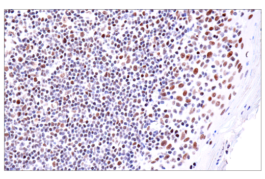 Immunohistochemistry Image 5: PBRM1/BAF180 (D4L9X) Rabbit mAb (BSA and Azide Free)