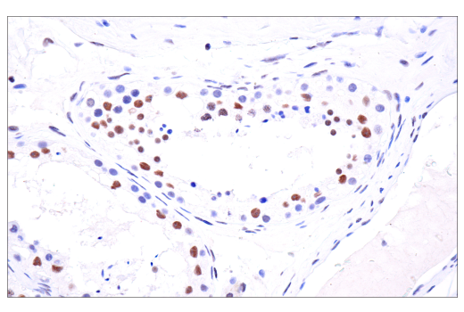 Immunohistochemistry Image 9: PBRM1/BAF180 (D4L9X) Rabbit mAb (BSA and Azide Free)