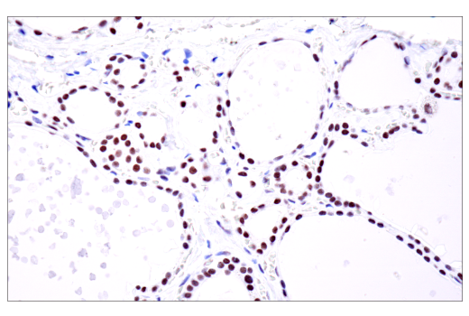 Immunohistochemistry Image 11: PBRM1/BAF180 (D4L9X) Rabbit mAb (BSA and Azide Free)