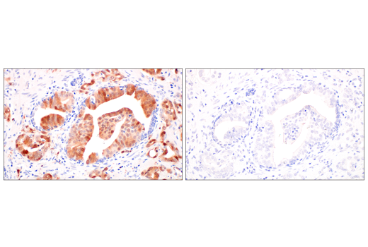 Immunohistochemistry Image 11: p16 INK4A (BC42) Mouse mAb