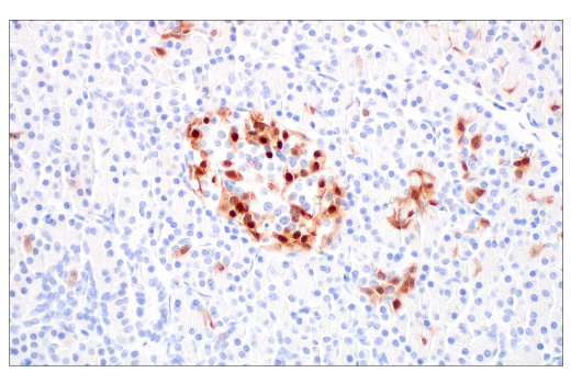 Immunohistochemistry Image 9: p16 INK4A (BC42) Mouse mAb