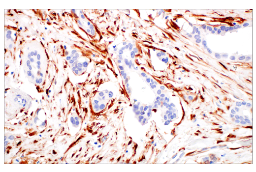 Immunohistochemistry Image 8: p16 INK4A (BC42) Mouse mAb