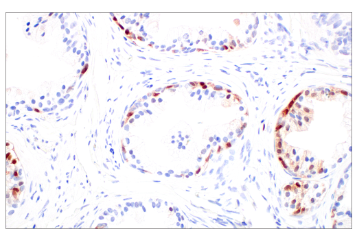 Immunohistochemistry Image 10: p16 INK4A (BC42) Mouse mAb
