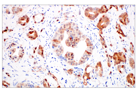 Immunohistochemistry Image 4: p16 INK4A (BC42) Mouse mAb