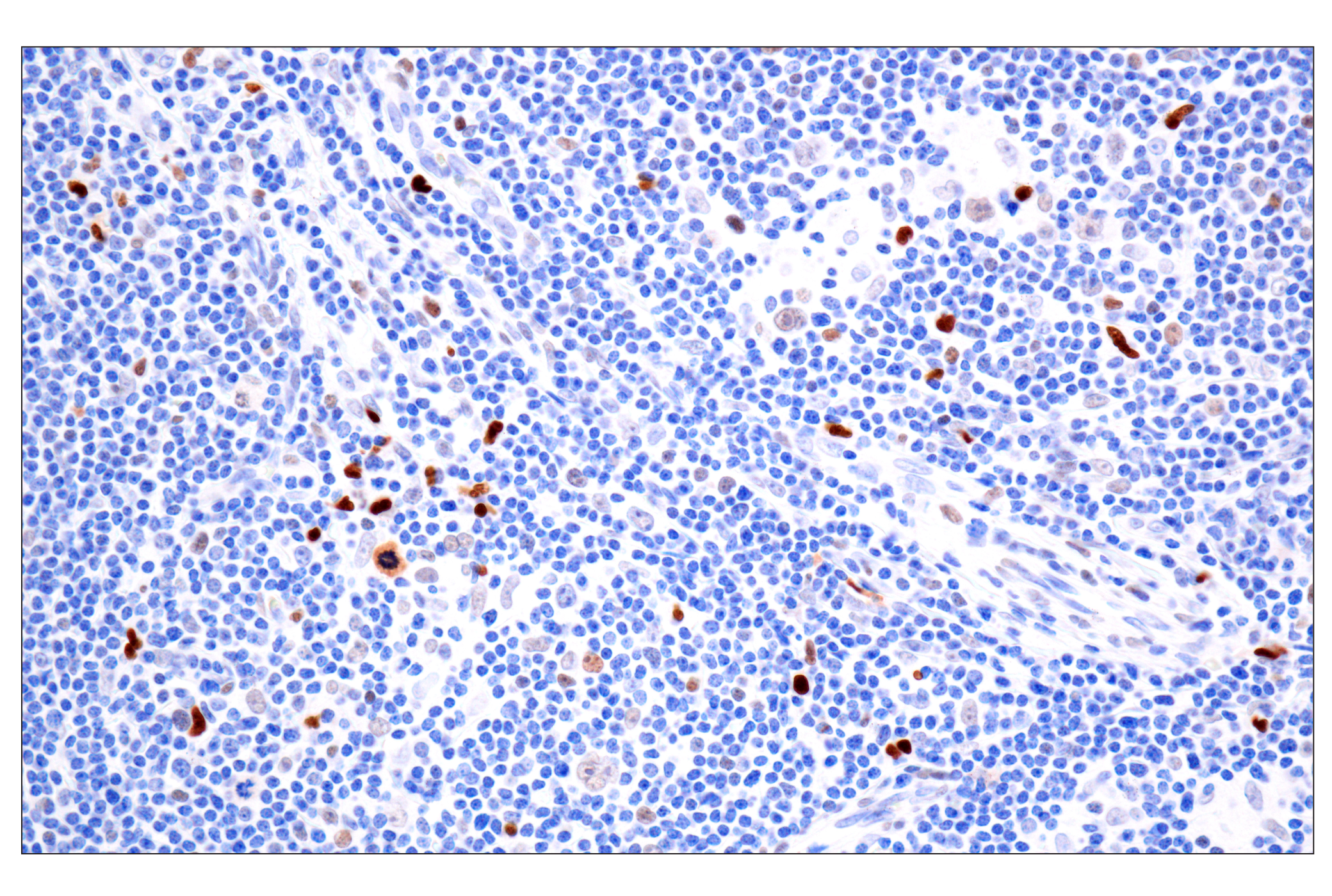 Immunohistochemistry Image 1: BATF3 (E3F3L) Rabbit mAb (BSA and Azide Free)