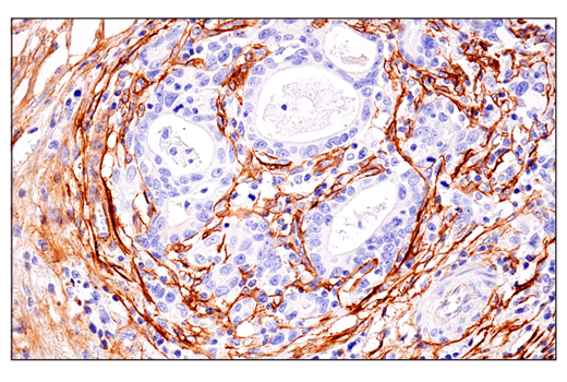 Immunohistochemistry Image 2: CD248 (E9Z7O) XP® Rabbit mAb (BSA and Azide Free)