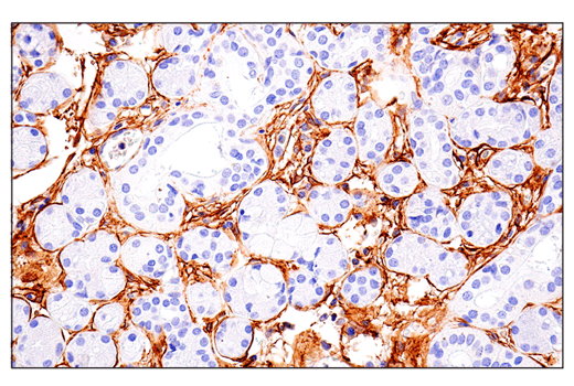 Immunohistochemistry Image 6: CD248 (E9Z7O) XP® Rabbit mAb (BSA and Azide Free)