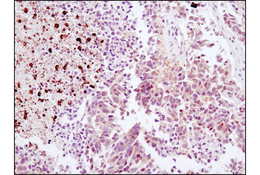  Image 21: Mouse Reactive Pyroptosis Antibody Sampler Kit