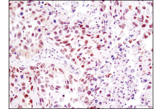  Image 26: Mouse Reactive Pyroptosis Antibody Sampler Kit