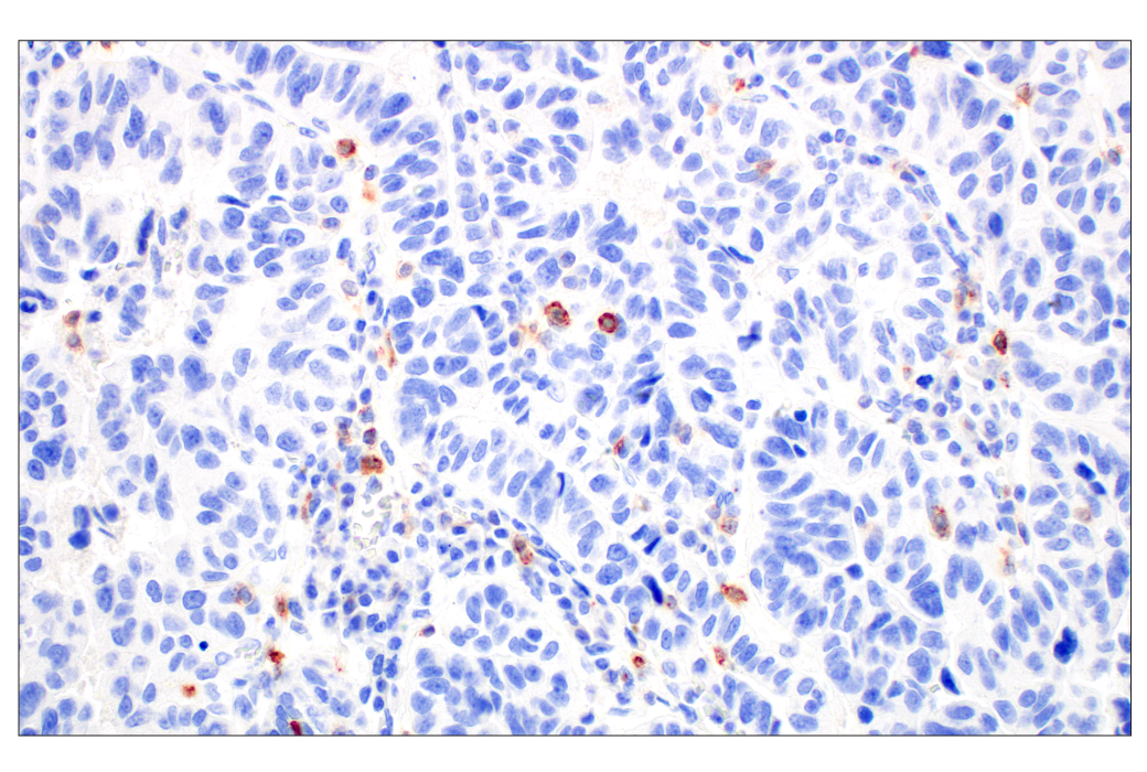 Immunohistochemistry Image 1: CD70 (E3Q1A) Rabbit mAb