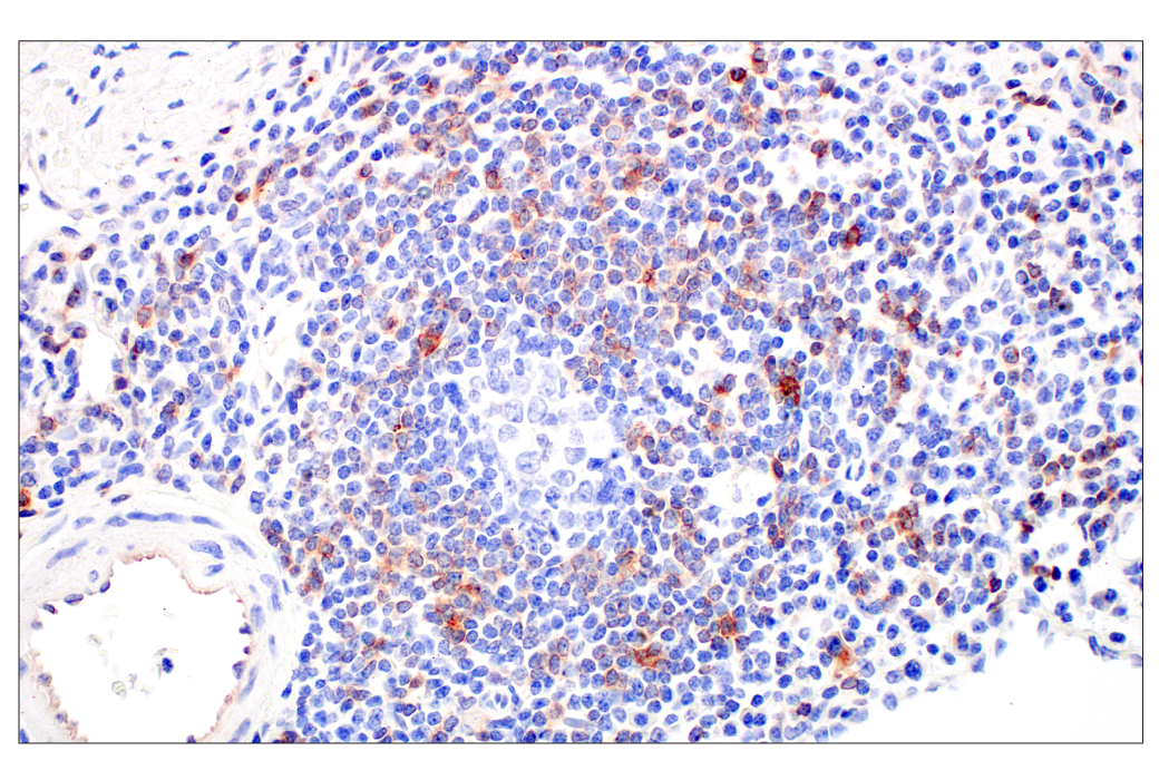 Immunohistochemistry Image 5: CD70 (E3Q1A) Rabbit mAb