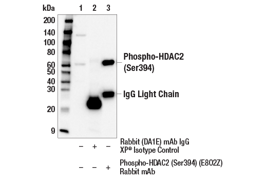Immunoprecipitation Image 1: Phospho-HDAC2 (Ser394) (E8O2Z) Rabbit mAb