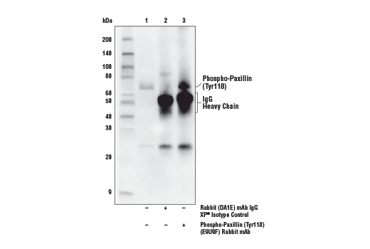 Immunoprecipitation Image 1: Phospho-Paxillin (Tyr118) (E9U9F) Rabbit mAb