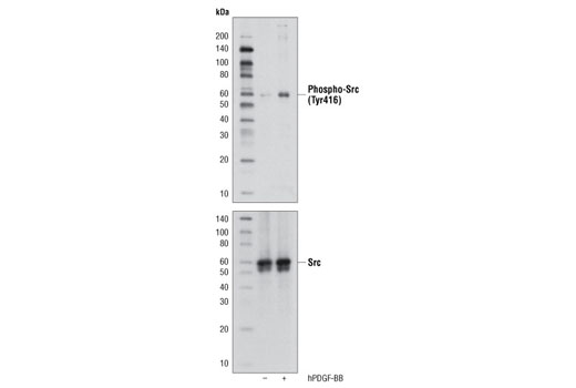  Image 7: B Cell Signaling Antibody Sampler Kit