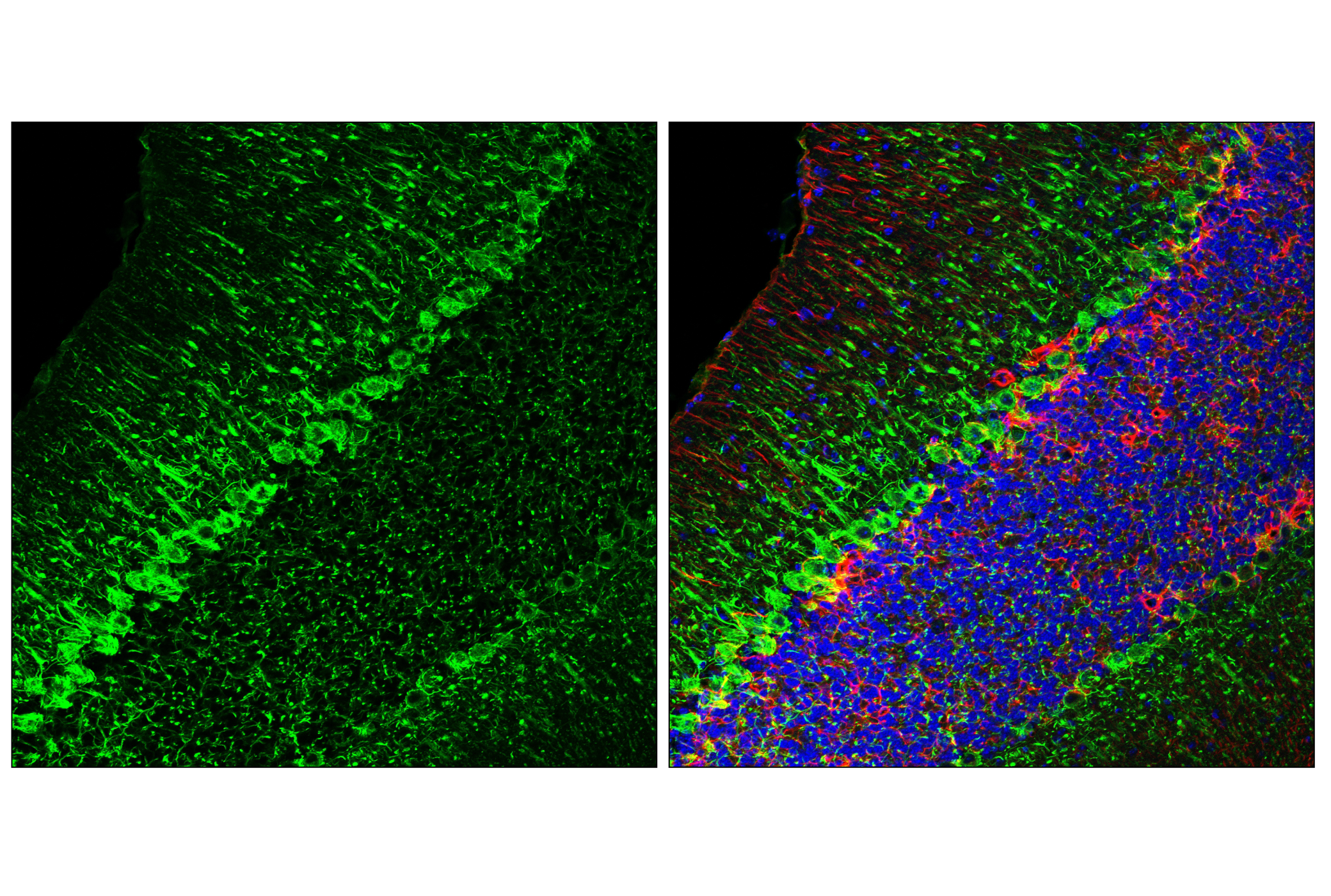 Immunofluorescence Image 2: Neurofilament-H (E9C9Z) Mouse mAb