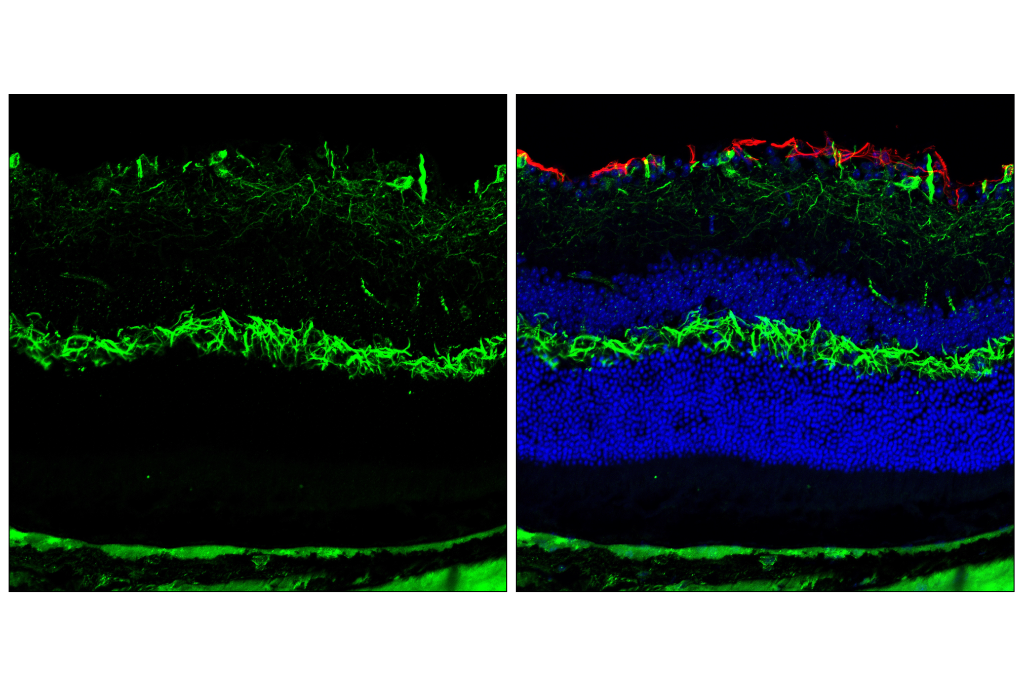 Immunofluorescence Image 3: Neurofilament-H (E9C9Z) Mouse mAb
