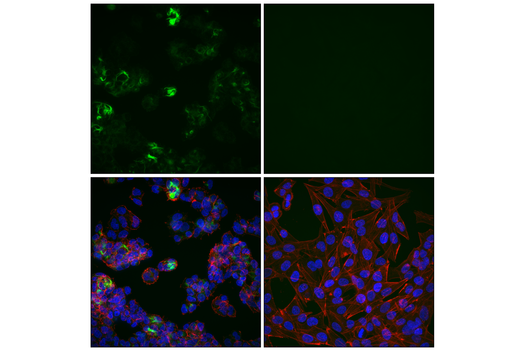 Immunofluorescence Image 4: Neurofilament-H (E9C9Z) Mouse mAb