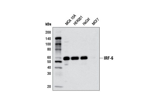 Western Blotting Image 1: IRF-6 Antibody