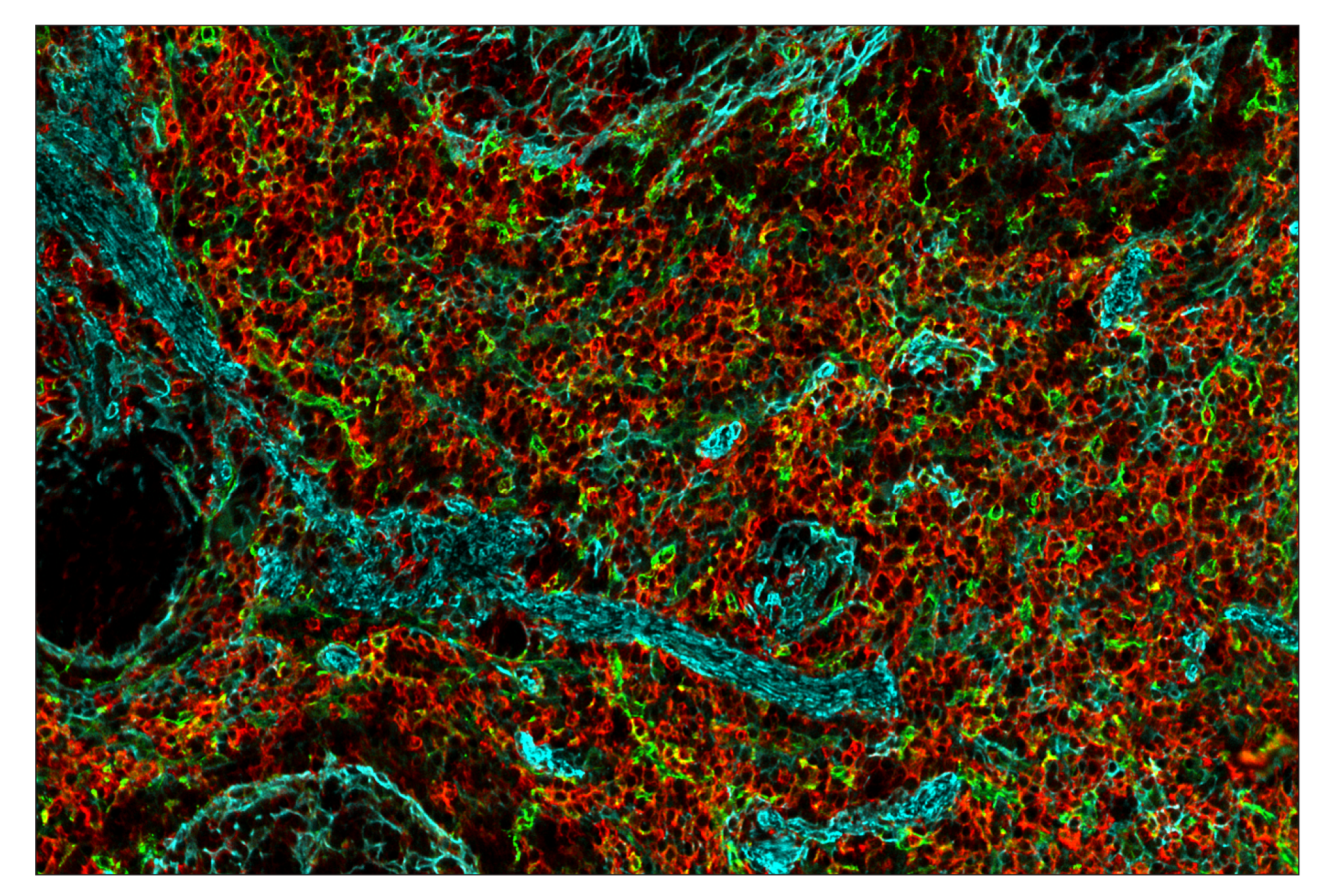 Immunohistochemistry Image 10: SIRPα/SHPS1 (D6I3M) & CO-0034-647 SignalStar™ Oligo-Antibody Pair