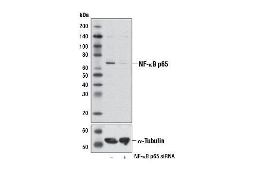  Image 24: NF-κB Family Member Antibody Sampler Kit