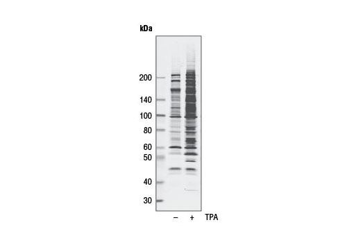  Image 3: Phospho-(Ser/Thr) Kinase Substrate Antibody Sampler Kit