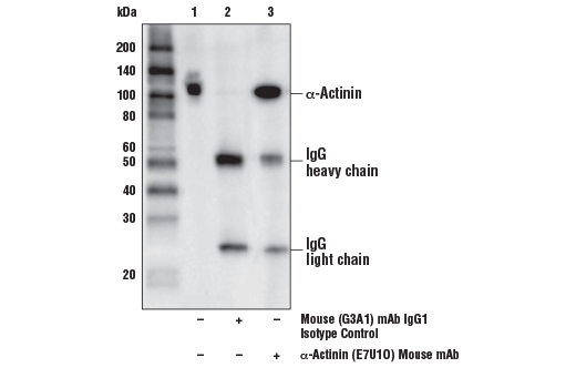 Immunoprecipitation Image 1: α-Actinin (E7U1O) Mouse mAb