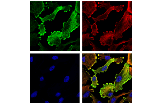 Immunofluorescence Image 1: α-Actinin (E7U1O) Mouse mAb