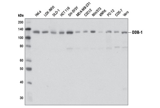  Image 8: Ubiquitin E3 Ligase Complex Antibody Sampler Kit