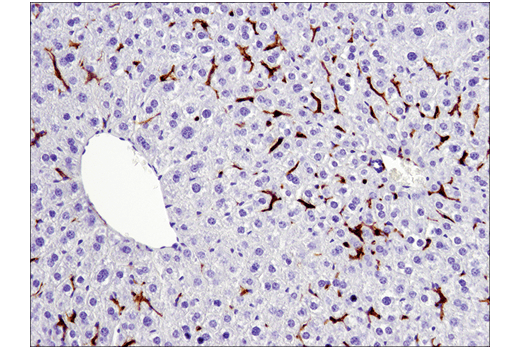  Image 15: Mouse Reactive M1 vs M2 Macrophage IHC Antibody Sampler Kit