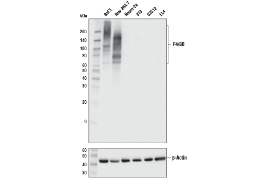  Image 7: Mouse Reactive M1 vs M2 Macrophage IHC Antibody Sampler Kit